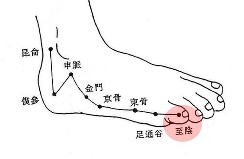 moxibustion-malposition-1